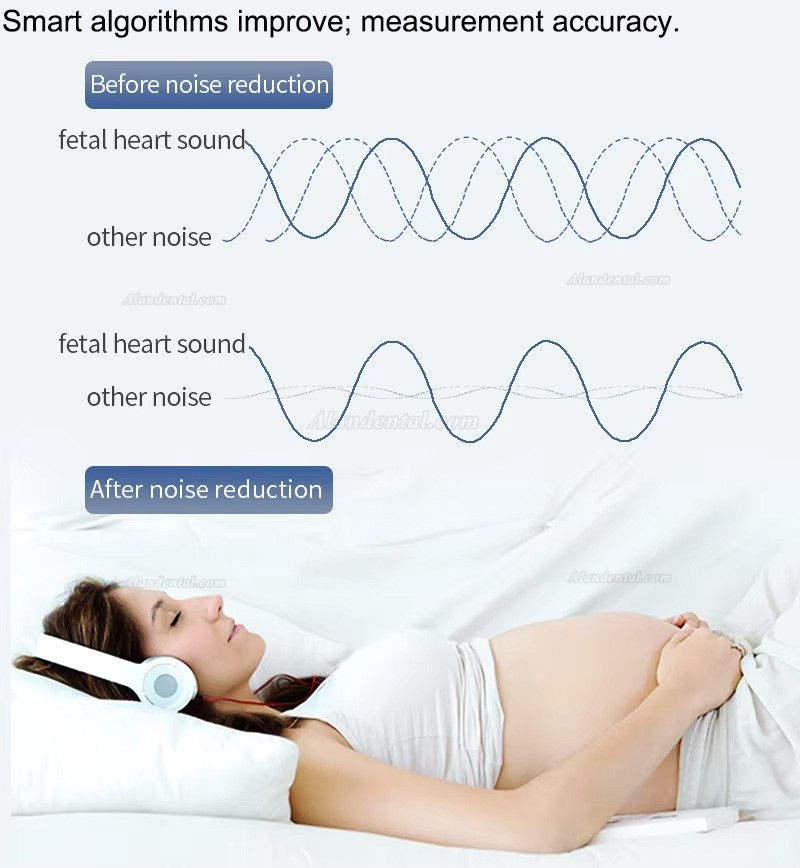CONTEC 10B LED Baby Sound Monitor Pocket Fetal Doppler